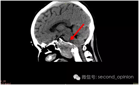 QQ图片20160518095431