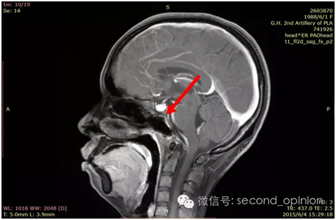 QQ图片20160518095717