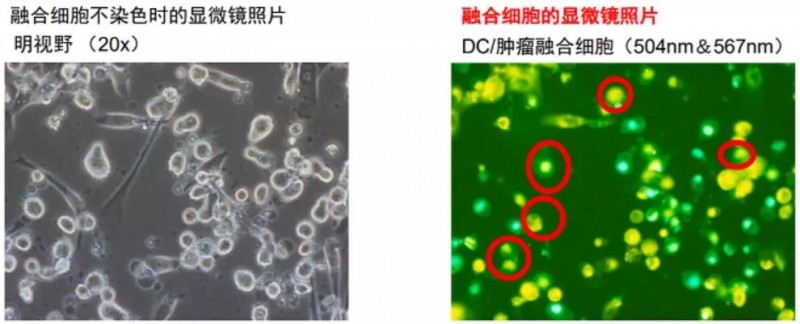 融合细胞显微镜下照片