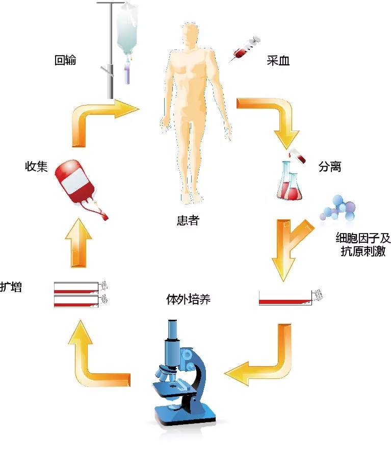 NK细胞治疗详细流程