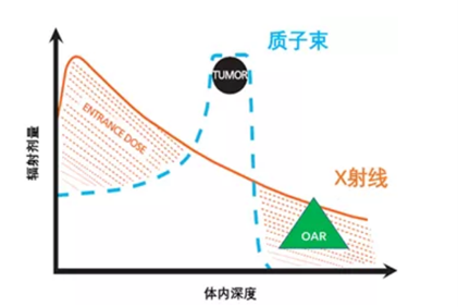 治愈李宗伟的质子治疗，是鼻咽癌患者的“救命神器”吗？