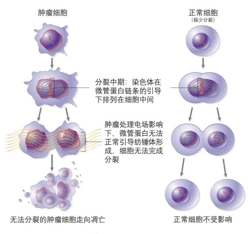 电场疗法治疗肺癌的原理