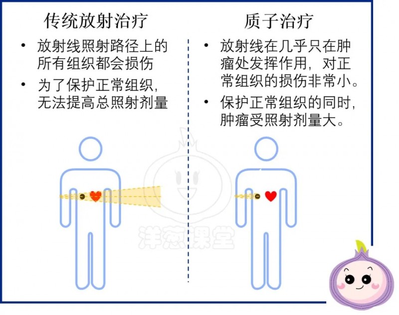 肿瘤放射治疗中的利刃——质子治疗