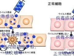 为什么越来越多的中国人去日本治疗癌症,日本抗癌抗肿瘤新技术,日本癌症治疗最新方法、最新技术、最新疗法你知道吗