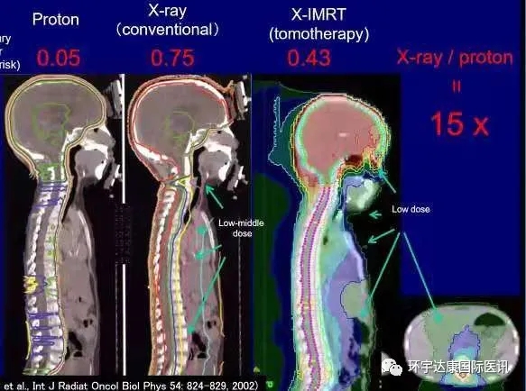 儿童肿瘤不同放疗技术对比