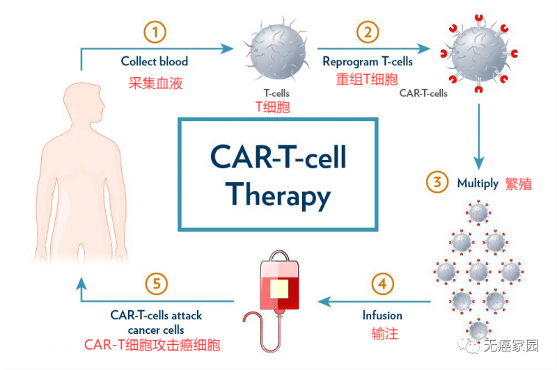 CAR-T细胞免疫疗法治疗流程