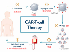 CAR-T细胞免疫疗法,CAR-T治疗让晚期癌症患者获得重生,CAR-T临床试验招募进行中