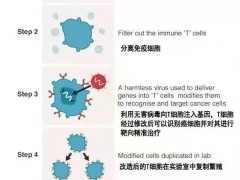 三大T细胞免疫疗法CAR-T细胞免疫疗法、TILs免疫疗法、TCR-T细胞疗法"歼灭"癌症肿瘤各显神通