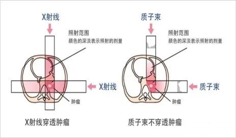 X射线和质子射线对比