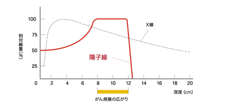 质子线和X射线对比