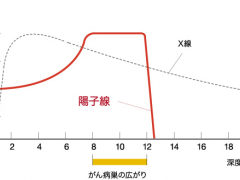 质子重离子治疗是什么意思