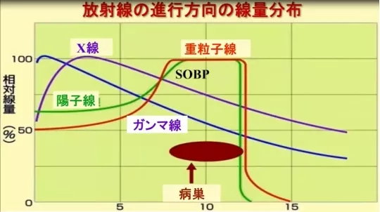 质子线、重离子线和X线对比