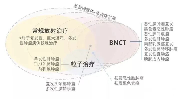 硼中子和其他放疗对比