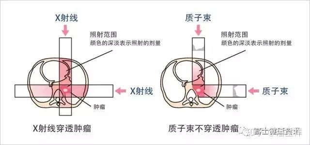 X射线和质子束对比