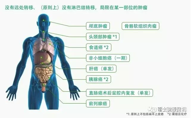 质子重离子可以治疗哪些肿瘤