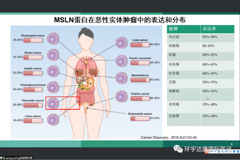 MSLN蛋白在恶性实体肿瘤中的表达和分布