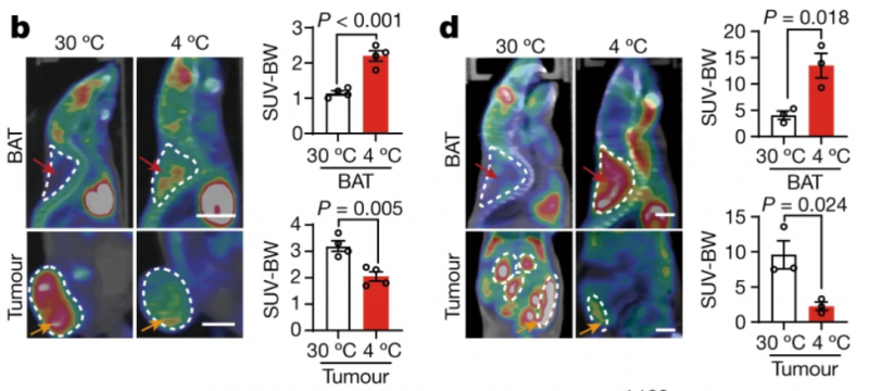 低温棕色脂肪对糖的消耗，肿瘤几乎摄取不到
