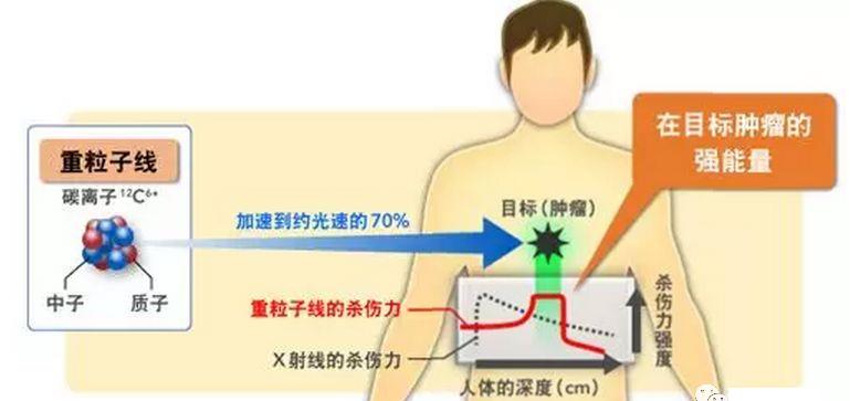 重离子治疗原理