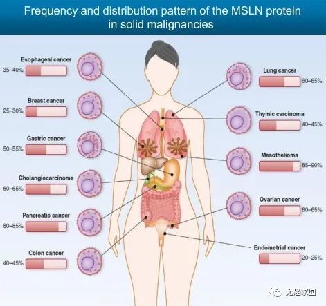 间皮素高表达的肿瘤