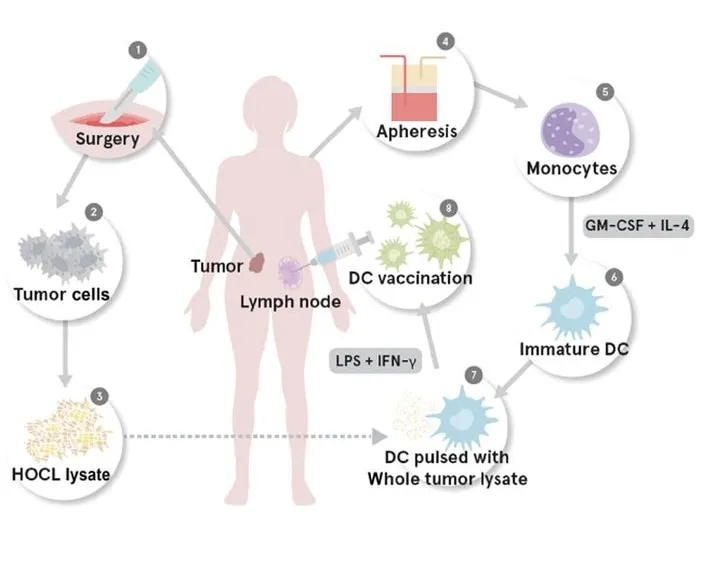 過繼性樹突細胞疫苗開發流程