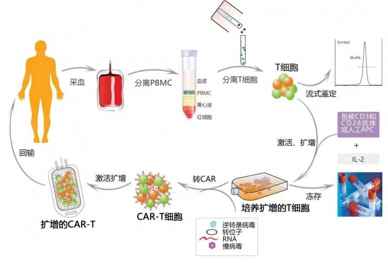 CAR-T细胞疗法治疗流程