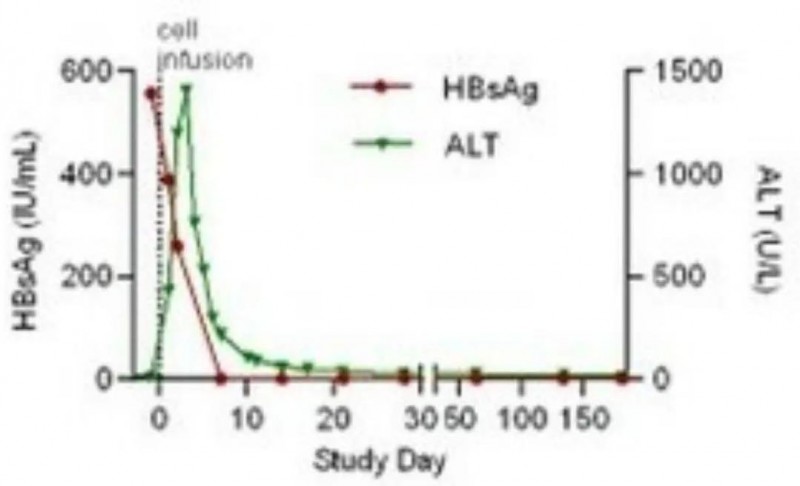 SCG101治疗宫颈癌前后HBsAg水平变化