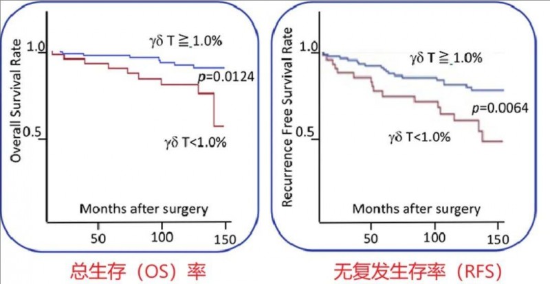 γδT细胞治疗肾癌的效果