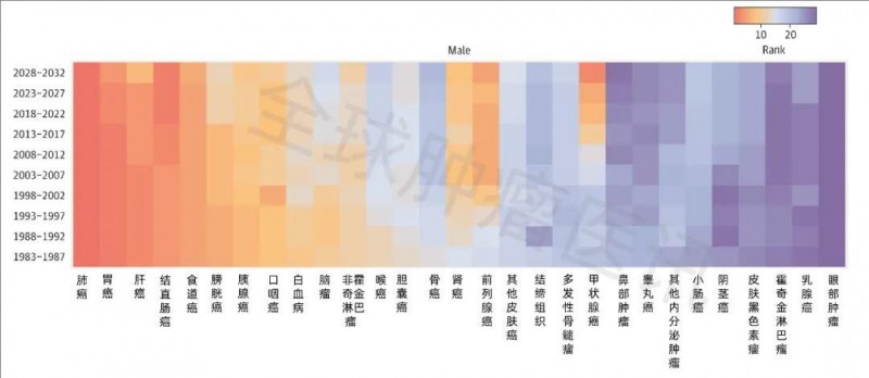 男性高发癌症
