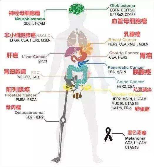 CAR-T可以治疗的肿瘤