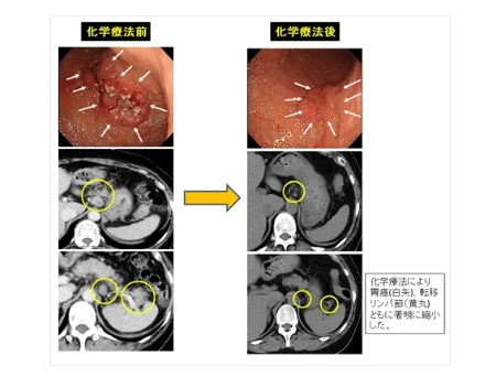 癌研有明医院