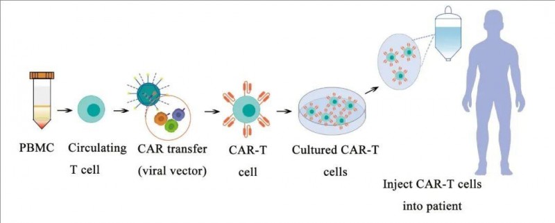 CAR-T疗法治疗流程