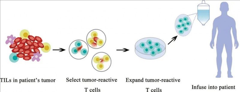 TIL细胞疗法治疗流程