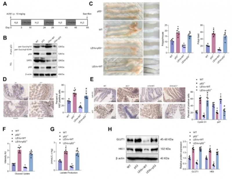 LEV介导的SIRT5/p53轴调节影响肠上皮细胞的增殖和糖酵解，从而影响结肠肿瘤的形成