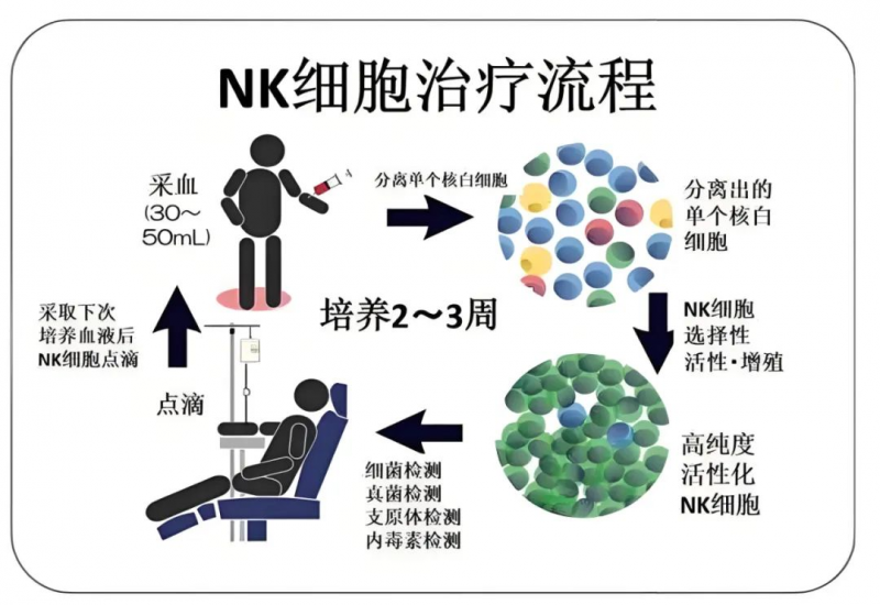 NK细胞治疗流程