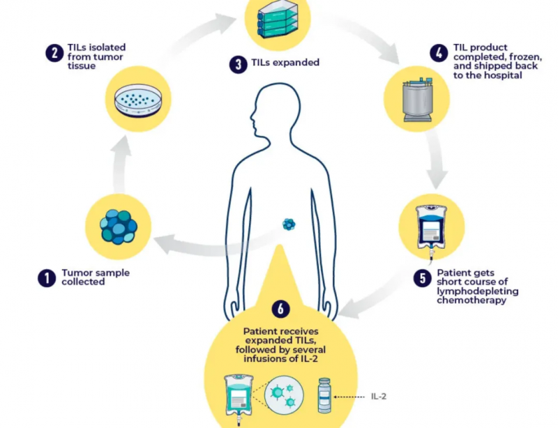 TIL疗法治疗流程