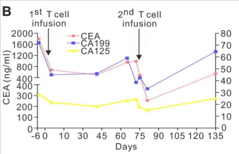 NY-ESO-1 TCR-T细胞疗法治疗肺腺癌的肿瘤标志物的变化