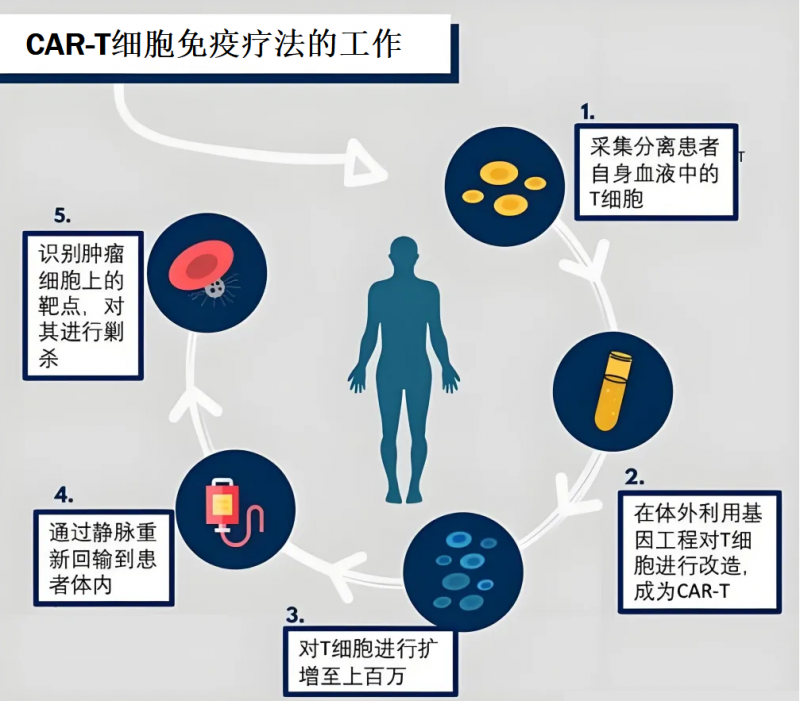 CAR-T细胞免疫疗法的工作流程