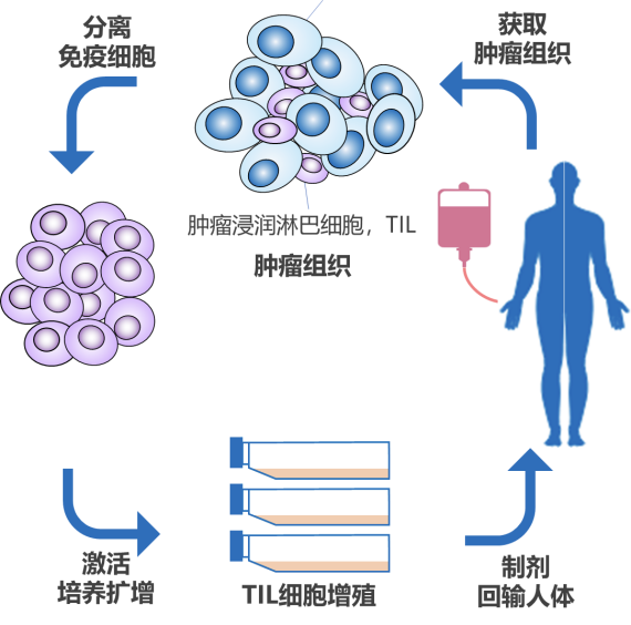 TIL细胞疗法治疗流程