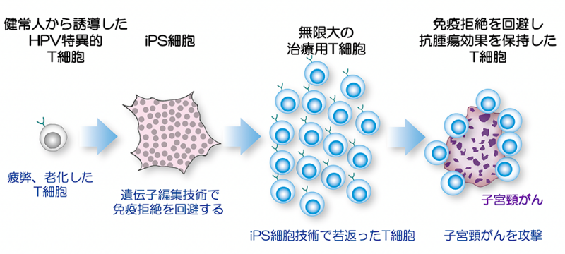 日本顺天堂大学IPS由来的CTL细胞疗法概念图