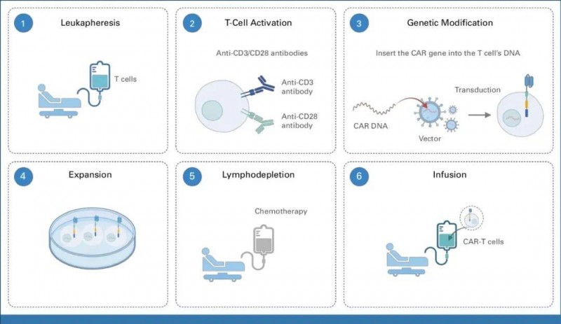 CART治疗流程