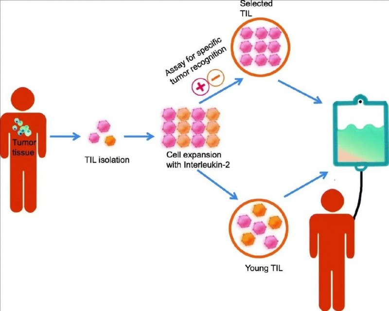 TIL细胞疗法的生产过程示意图