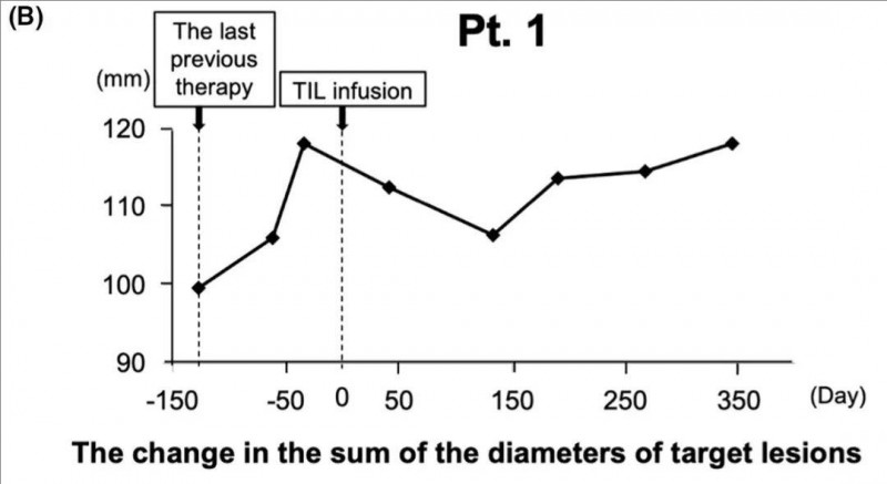 TILs细胞疗法治疗黑色素瘤的数据