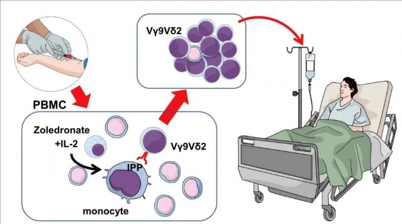 Vγ9Vδ2T细胞疗法