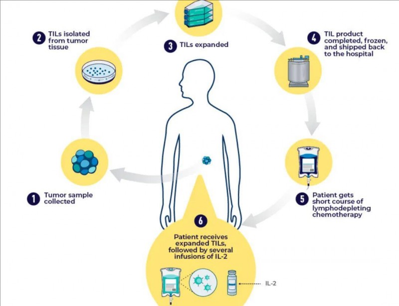 TILs细胞疗法治疗流程