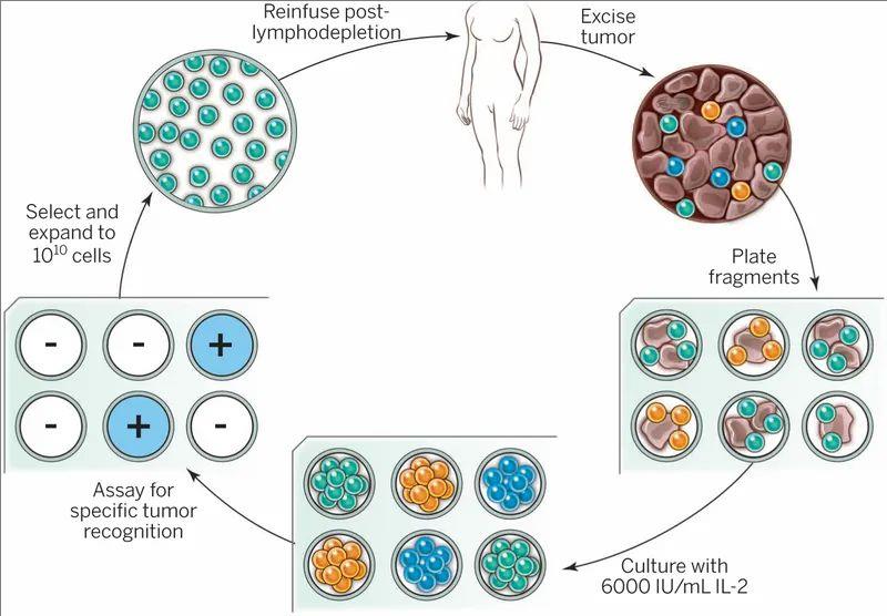 TIL细胞疗法治疗流程