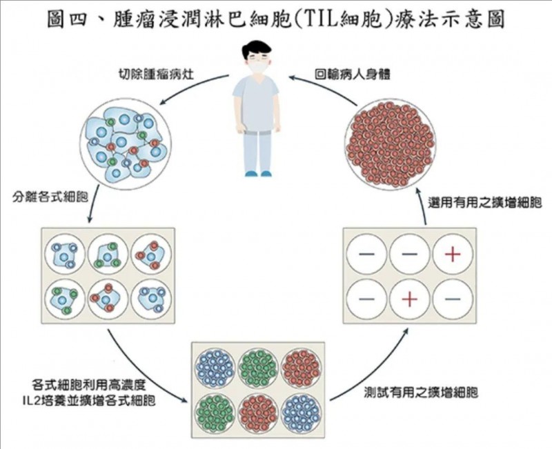 TIL细胞疗法示意图