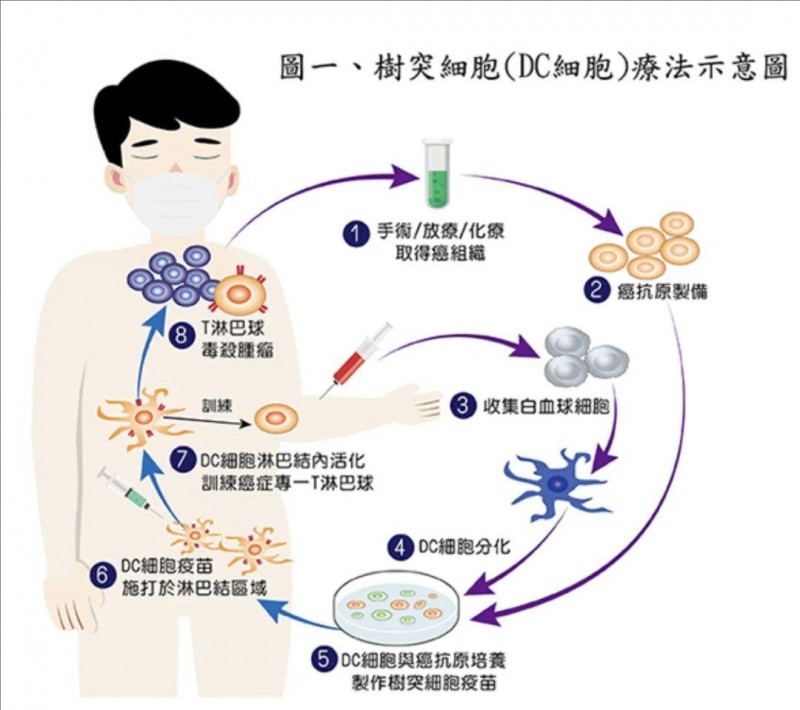 树突细胞疗法示意图