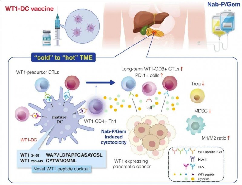 WT1-DC疫苗